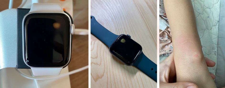 Imagens do Apple Watch com a mancha amarela no canto superior direito e do pulso do utilizador vermelho depois do Apple Watch sobreaquecer.